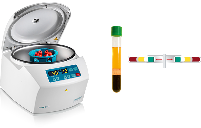 Hettich - 270COMPLETE - EBA 270 Small Centrifuge, Complete Package 6